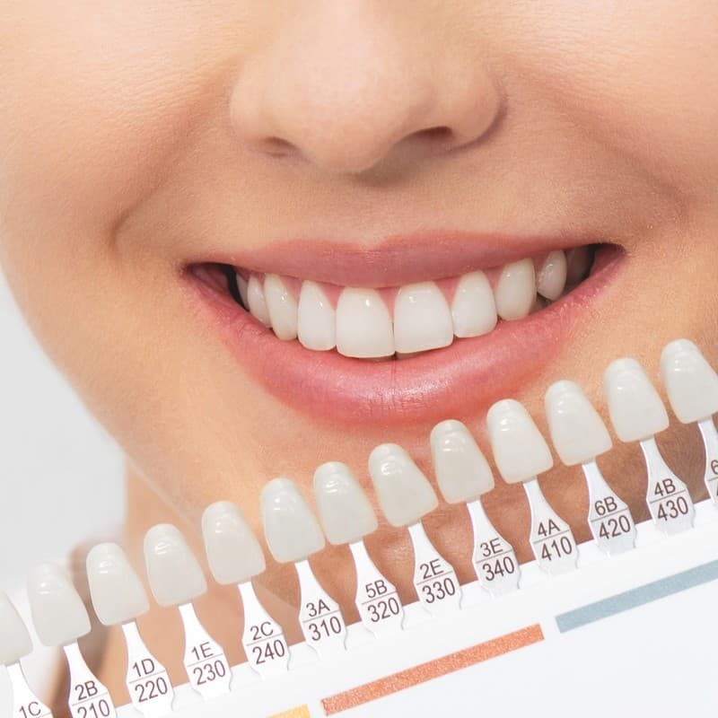 Tratamientos odontológicos